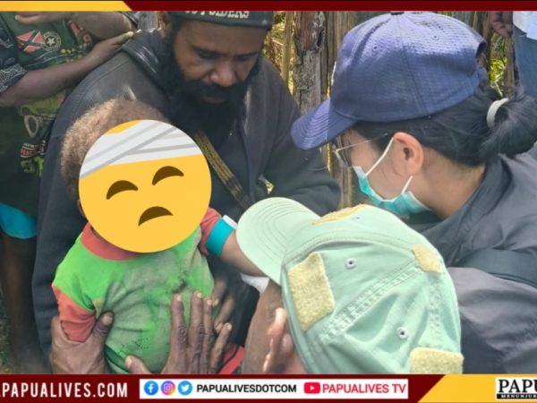 Tanggapi Dugaan Kasus Campak di Dogiyai, Dinkes Papua Tengah Turun Langsung Lakukan Penyelidikan Epidemiologi